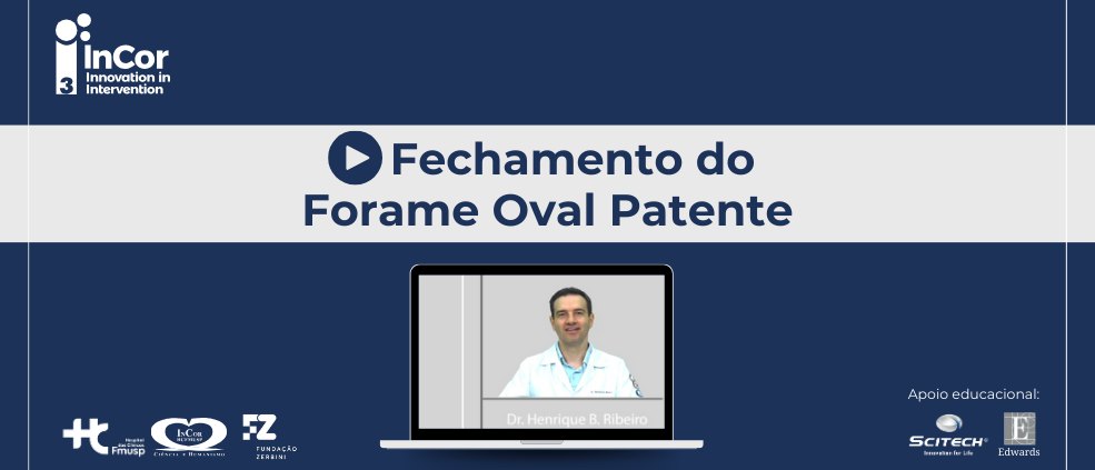 Assista ao vídeo do Dr. Henrique Ribeiro e entenda o que é o forame oval patente (FOP) e como ele pode ser diagnosticado na população adulta.