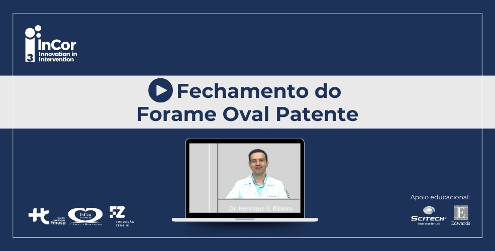 Assista ao vídeo do Dr. Henrique Ribeiro e entenda o que é o forame oval patente (FOP) e como ele pode ser diagnosticado na população adulta.