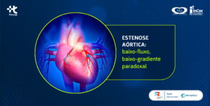 A estenose aórtica baixo-fluxo, baixo-gradiente paradoxal: critérios diagnósticos e função ventricular preservada.