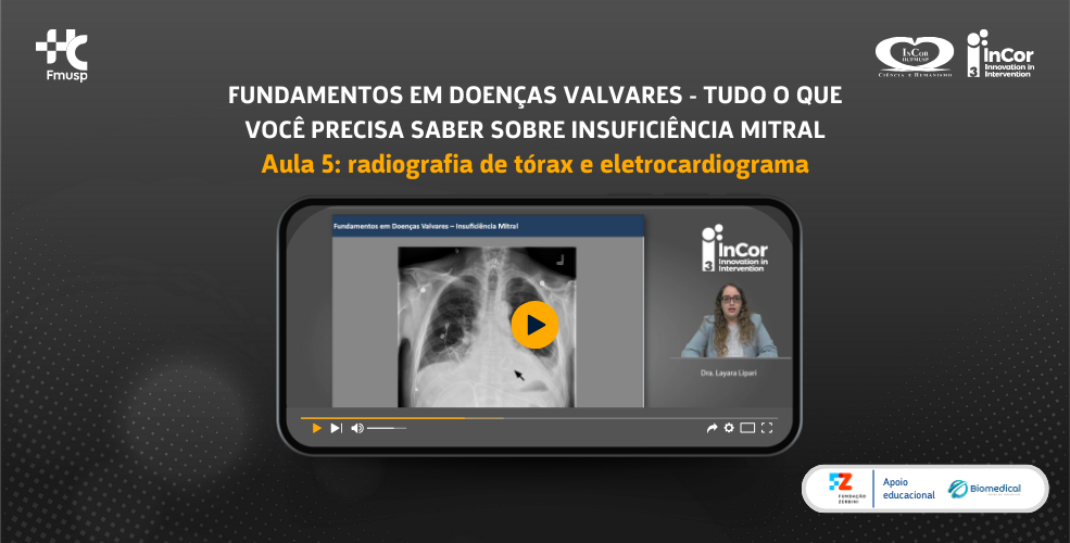 Fundamentos em doenças valvares – tudo o que você precisa saber sobre insuficiência mitral Aula 5: radiografia de tórax e eletrocardiograma