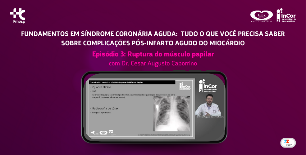 Etiologia e Fisiopatologia da Insuficiência Mitral